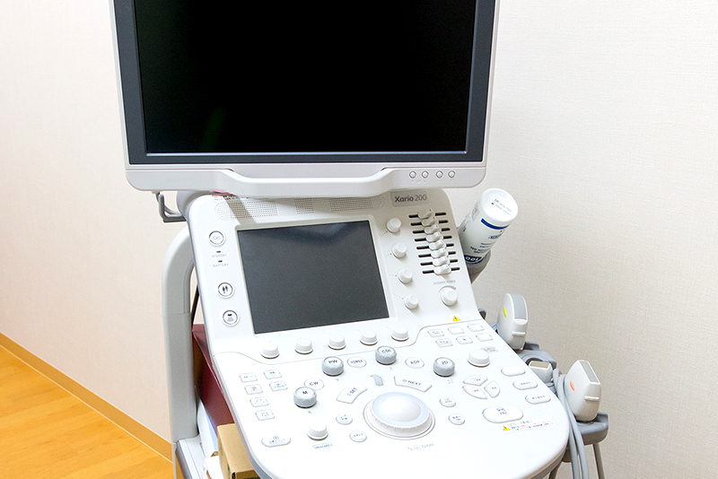 超音波検査装置